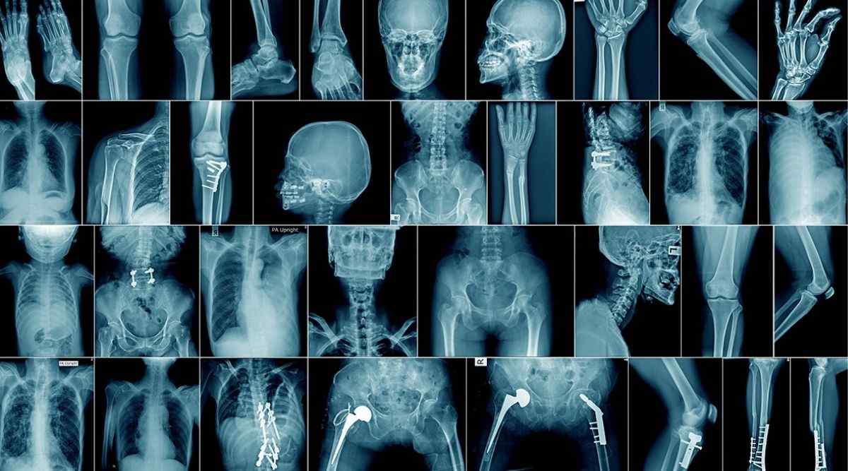Radiology Courses After 12th: Degree, Diploma, Certificate